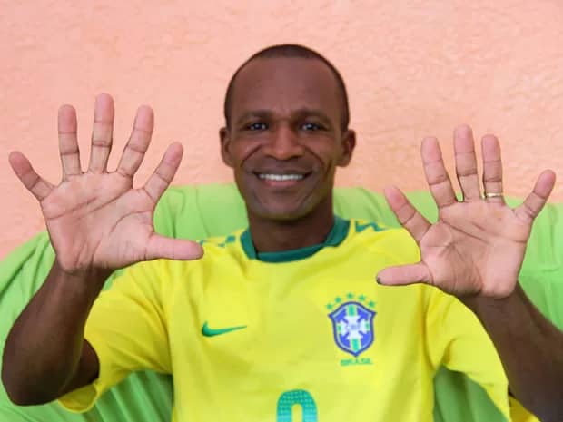 Foto de Josevaldo de Almeida Thomé exibindo com orgulho seus seis dedos em cada mão, usando a camisa da seleção canarinho.